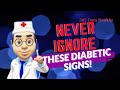 8 diabetic signs and symptoms you must never ignore 365 days healthy