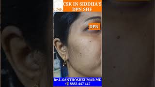 #dpntamil #faceblackdots #skincare DPN Face black dots