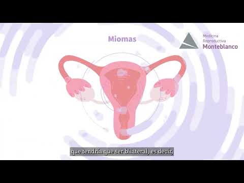 Video: 3 formas de calcular la duración del ciclo menstrual