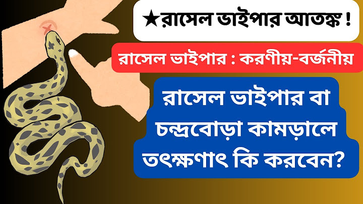 রাসেল ভাইপার কামড়ালে কি করতে হয়?| কিভাবে রাসেল ভাইপারের কামড় থেকে বাঁচবেন?| চন্দ্রবোড়া সাপ |Trends