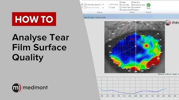 How To | Analyse Tear Film Surface Quality (Studio 6)
