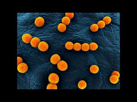 Wideo: Enterococcus Faecalis: Przyczyny, Objawy I Leczenie