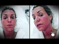 Renata Banhara fala da luta contra doença grave: “Minha cabeça chegou a pesar um 1,5 kg a mais”
