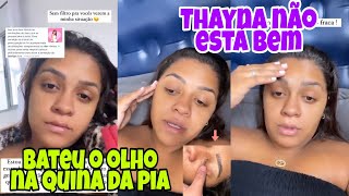 Thayna Thalita Não Está Bem E Bateu O Olho Na Quina Da Pia