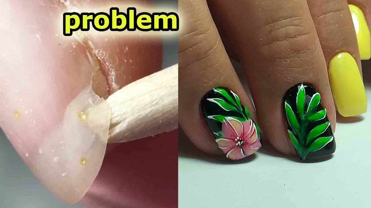 tutorial- Torn or Detached Nail Treatment ❤  TROPICAL FLOWERS on nails