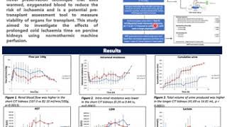 EXCISE Poster Presentation: San Myat- The Effect of Cold Ischemia Time