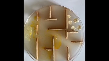 Le déplacement d’un Blob ( Time Lapse )