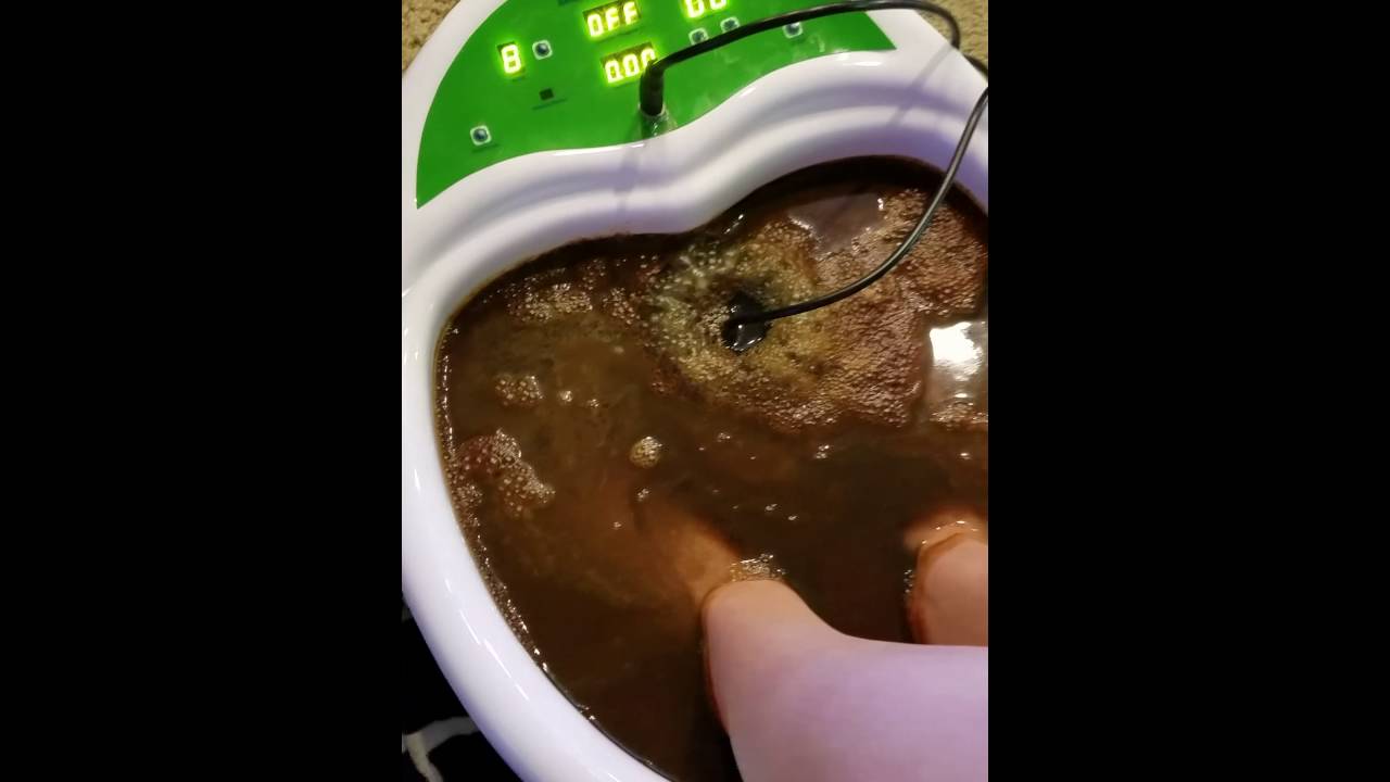 Foot detox bath for Lyme Disease YouTube