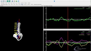 Spinal Motion: Capture and analysis with The MotionMonitor xGen