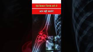 Types of Fractures Explained | Bone Breaks You Should Know