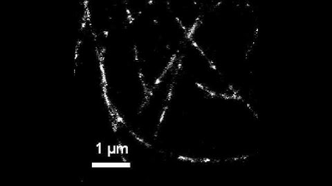 STORM experiment with immunostained microtubules