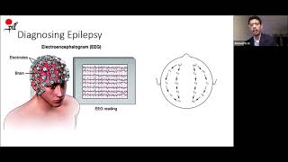 Diagnostic Challenges in Epilepsy and Epilepsy Syndromes