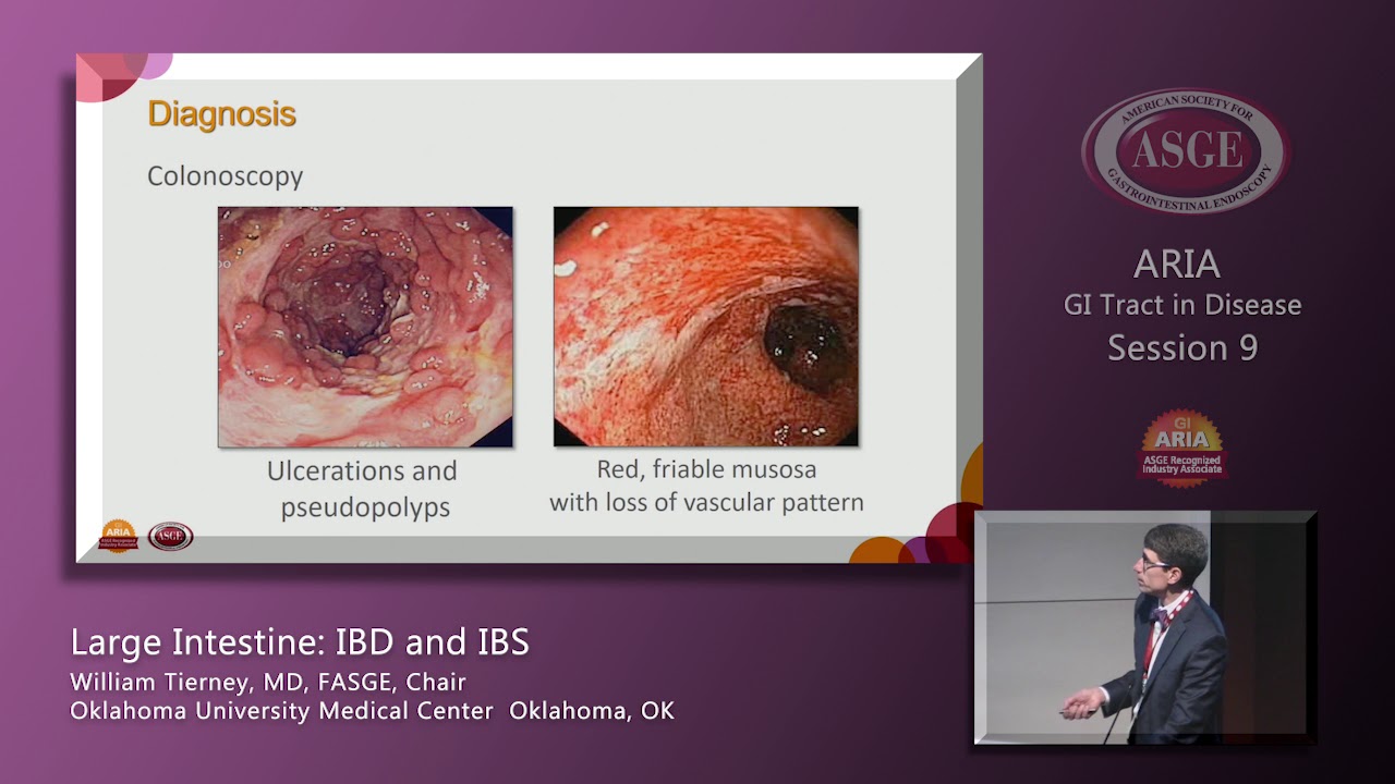 Large Intestine In Disease IBD And IBS YouTube large-intestine-in-disease-ibd-and-ibs-youtube