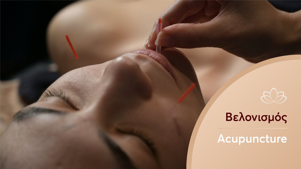 Βελονισμός - Acupuncture στο Invoid Massage & Spa