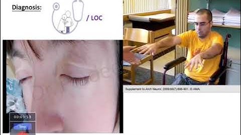 Status Epilepticus  | Dr. Pradeep Rangappa