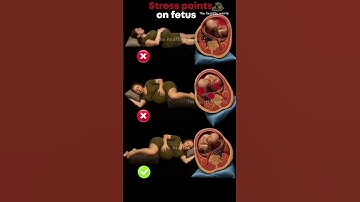 Pressure on fetus according to sleeping positions during pregnancy #sleepmusic #baby #pregnancy