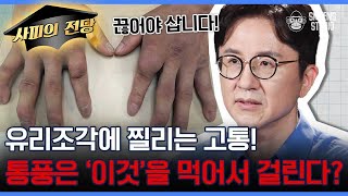 왕들의 병! 병들의 왕, 통풍! 절대 완치 불가 통풍을 잘 데리고 사는 관리법은? [서재걸의 면역내과 EP.6]