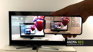 INSIGHT HEART - using AirPlay