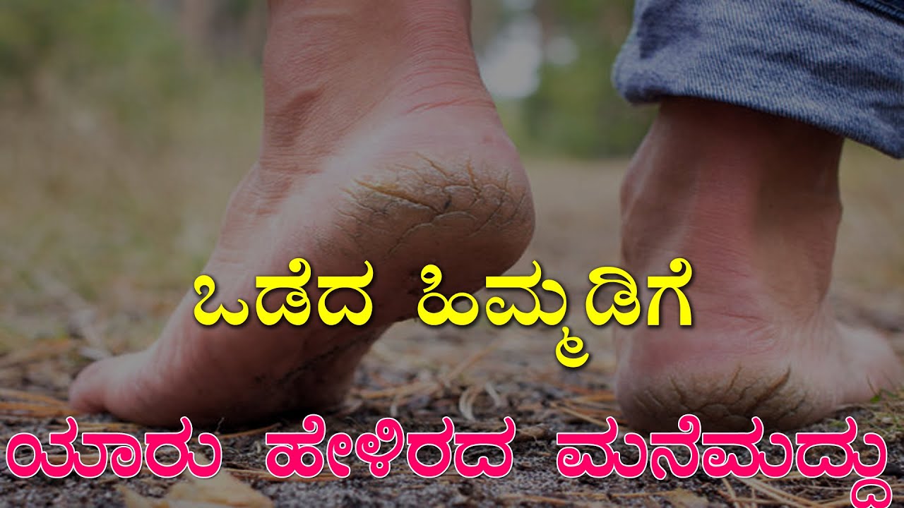 Odeda Himmadi Ge Mane Maddu Crack Heels Home Remedy In Kannada How odeda-himmadi-ge-mane-maddu-crack-heels-home-remedy-in-kannada-how