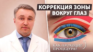 Как вернуть глазам открытый молодой взгляд? 👁️ Блефаропластика