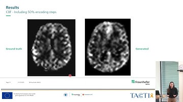 Advanced Research Projects Showroom - Rapid Parameter Maps of Sparse Hadamard-Encoded ASL MRI by ML