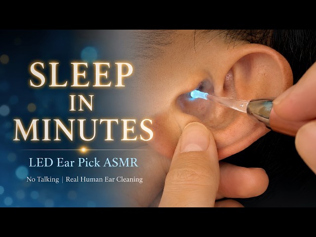 LED Ear Pick ASMR 😴 | No Talking | Real Human Ear Cleaning