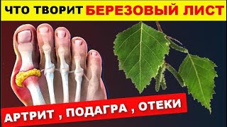 ТАК растворяют Мочевую Даже в 90 лет! От Болей в Суставах, Подагры, Отеков .Что чинит БЕРЕЗА ...