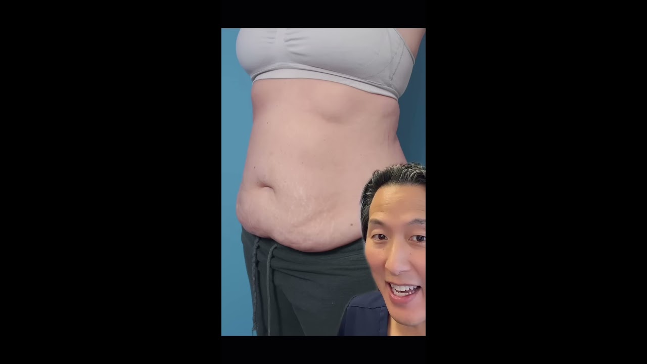 Tummy Tuck REVEAL Shorts Tummytuck