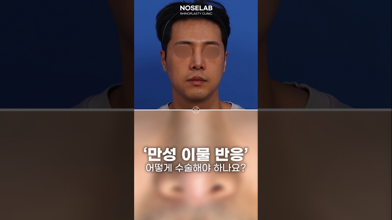 실리콘 이물반응으로 코재수술이 필요한 위험 신호