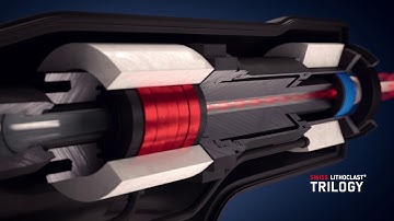 Swiss LithoClast® Trilogy - the Power of 3 for PCNL and complex kidney stone treatments