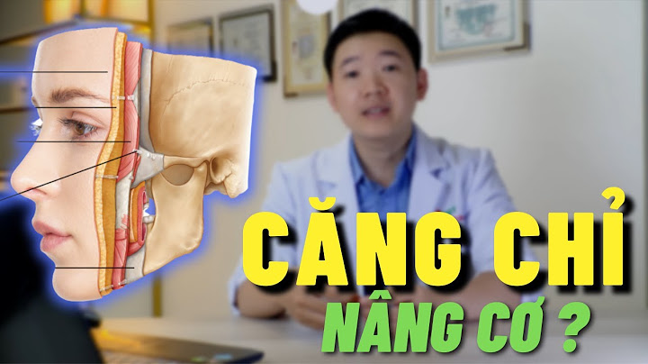 Căng chỉ nâng cơ mặt giá bao nhiêu