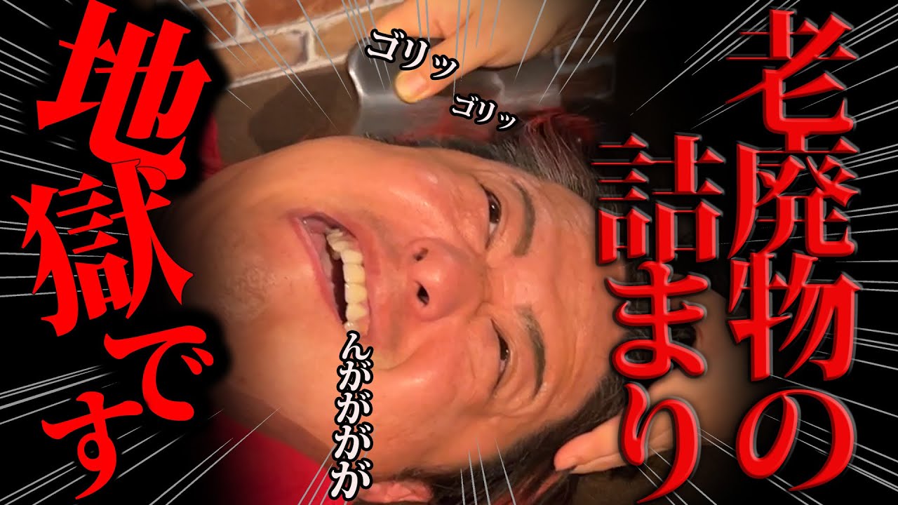 「麻酔くれぇぇえ！」激痛すぎて常時暴れまわる重症患者を悶絶施術でスッキリ解消しました！ @matsuwota