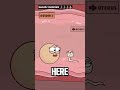 # #medical students #animation #genetic problem in beby animation video #funny #shortvideo #medicale