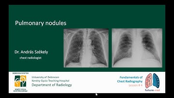 Fundamentals of Chest Radiography - Lesson 4.