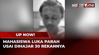 Dituduh Melakukan Pelecehan Seksual, Mahasiswa Dikeroyok 30 Orang Hingga Cacat & Trauma | UP NOW!