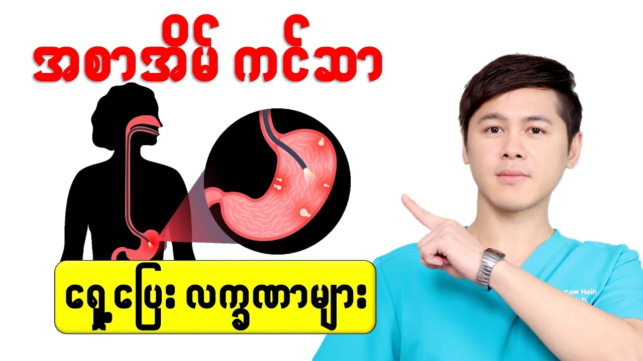 -- အစာအိမ်ကင်ဆာ ရှေ့ပြေးလက္ခဏာ (၅) မျိုး --