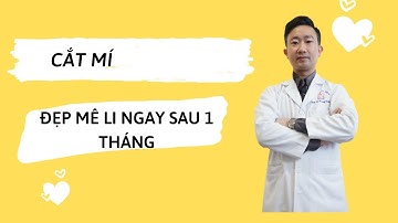 Cắt mí sau 1 tháng/  Bác sỹ Tuấn Dương