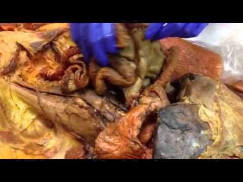 Cadaver Anatomy- organs - YouTube