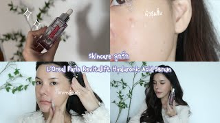 Skincare ลูกรักตัวช่วยเรื่องผิวขาดน้ำ L’Oreal Paris Revitalift Hyaluronic Acid Serum