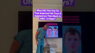 Super Optimizing Strategy For Optimizing Your Health, Appearance Performance Extended Fasting