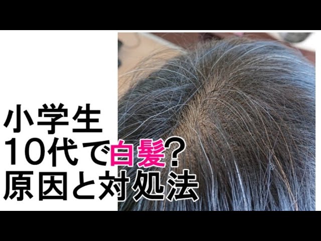 小学生から1０代の若白髪の原因を 育毛のプロが解説します Youtube