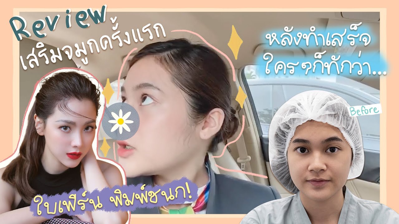 รีวิวเสริมจมูกครั้งแรกบอกหมอมิว ขอแบบใบเฟิร์น พิมพ์ชนก! หมอมิว Someko จัดให้
