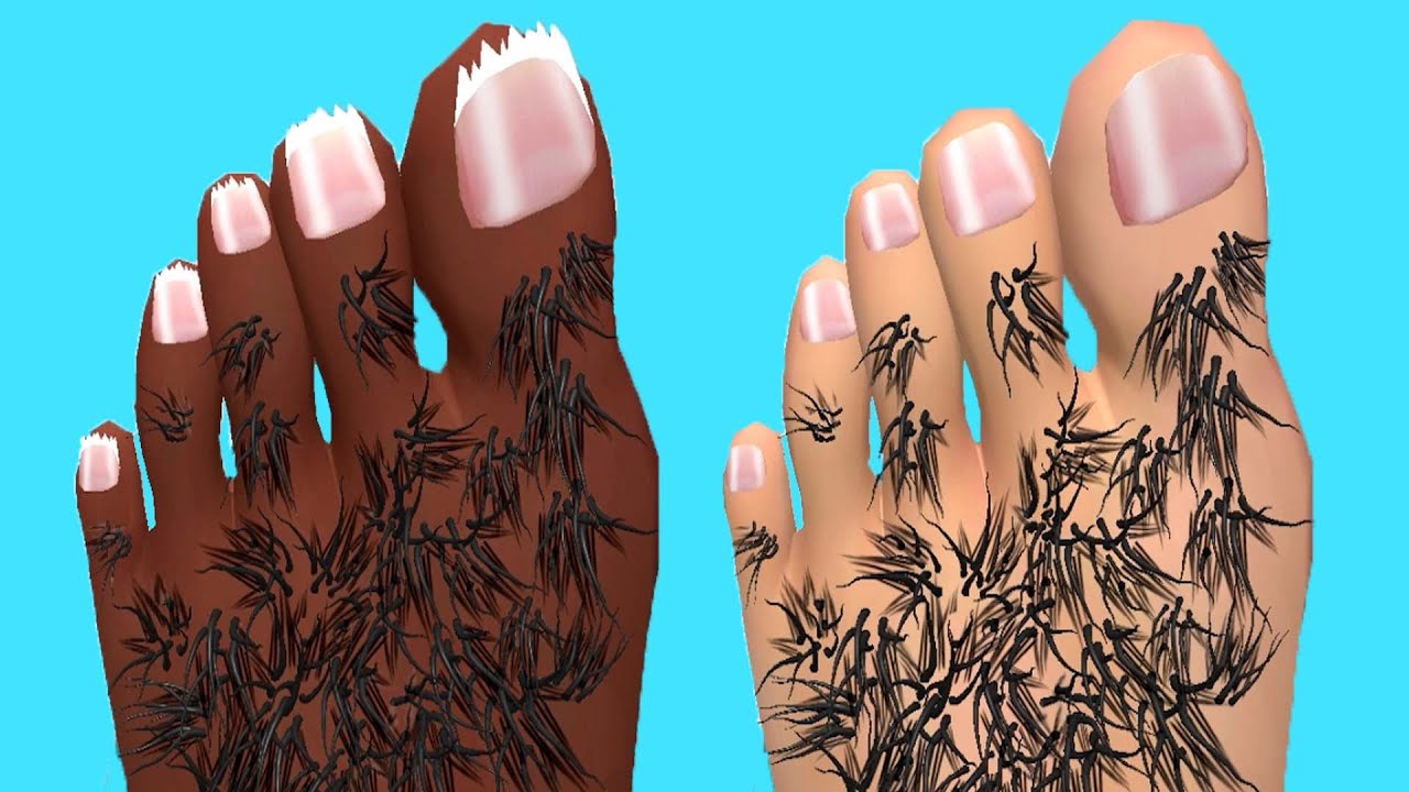 Foot Clinic - Gameplay Walkthrough - All Levels (IOS, Android)