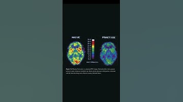 Myth Busted: A Smart Brain Doesn