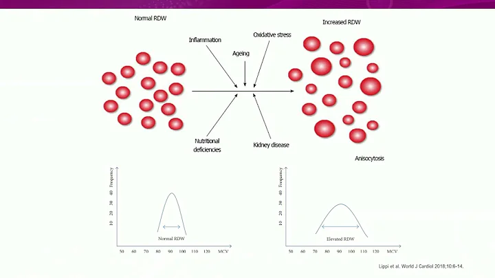 Hematología: aprovechando el poder del CBC