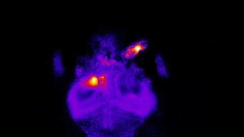 Time-Lapse: Zebrafish Neural Response to Prey by Dr. Akira Muto