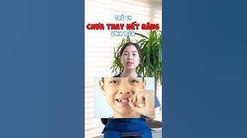 Cho trẻ niềng răng khi chưa thay hết răng có được không? #shorts