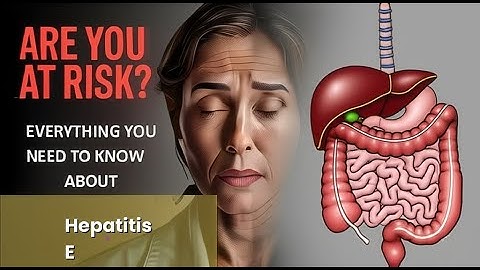 Hepatitis E Explained Causes, Symptoms and Treatment, All Insights