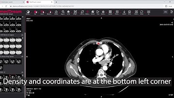 MedDream DICOM Viewer: the Intensity function