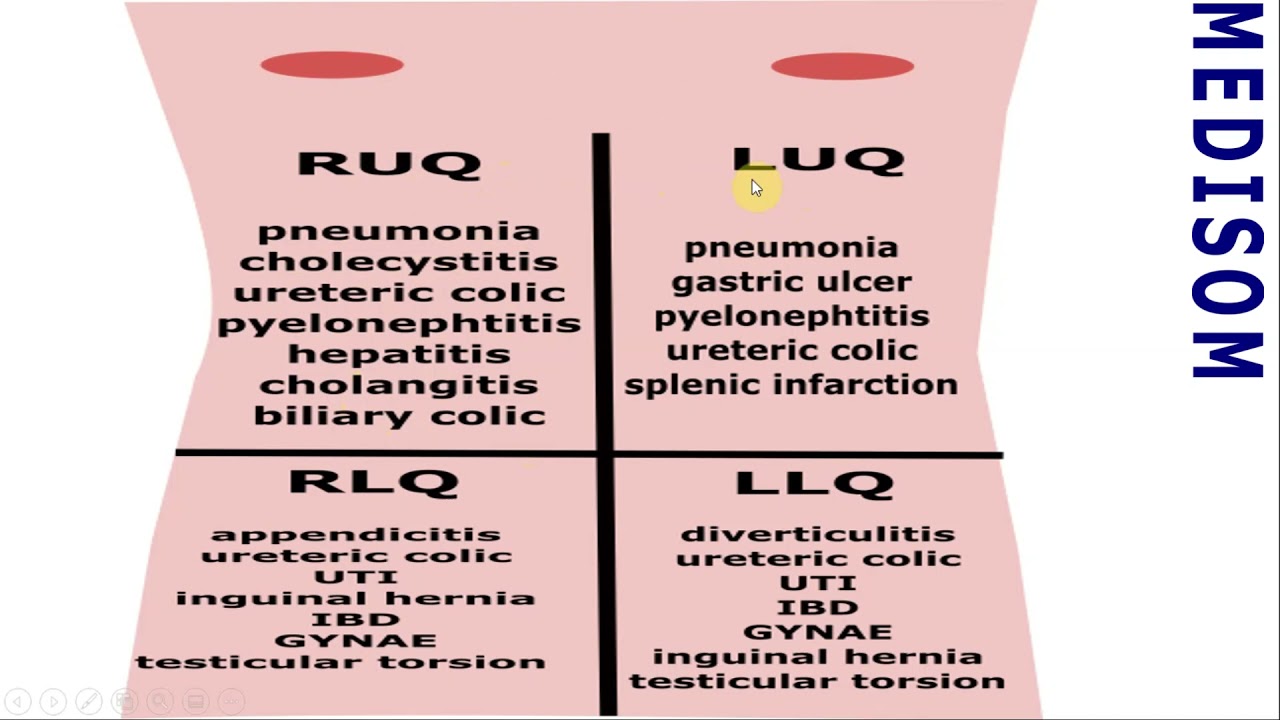 AF SOMALI ACUTE ABDOMEN